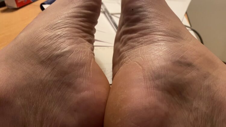 jonasalmostfamous feet 3