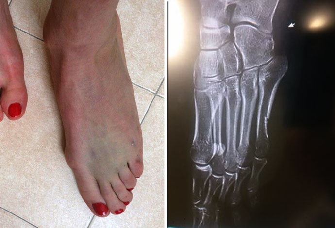 justyna kowalczyk feet 5