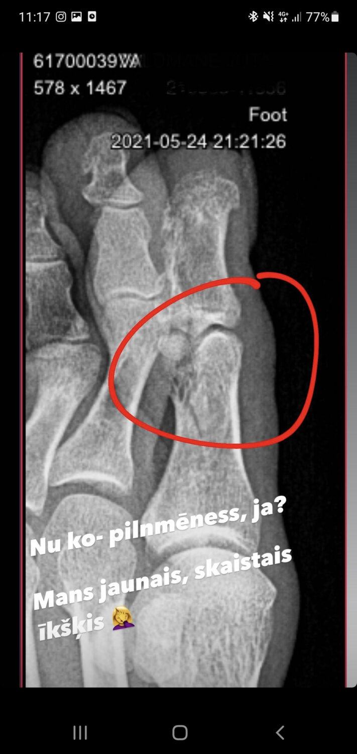 juta valdmane feet 4