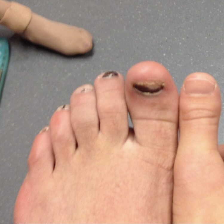 kaetlyn osmond feet 4