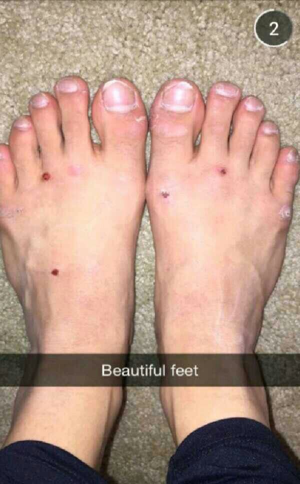 kalani hilliker feet