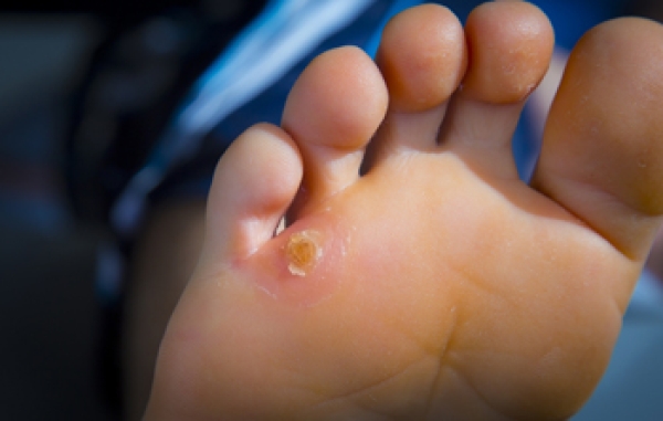 kaniya harden feet 4