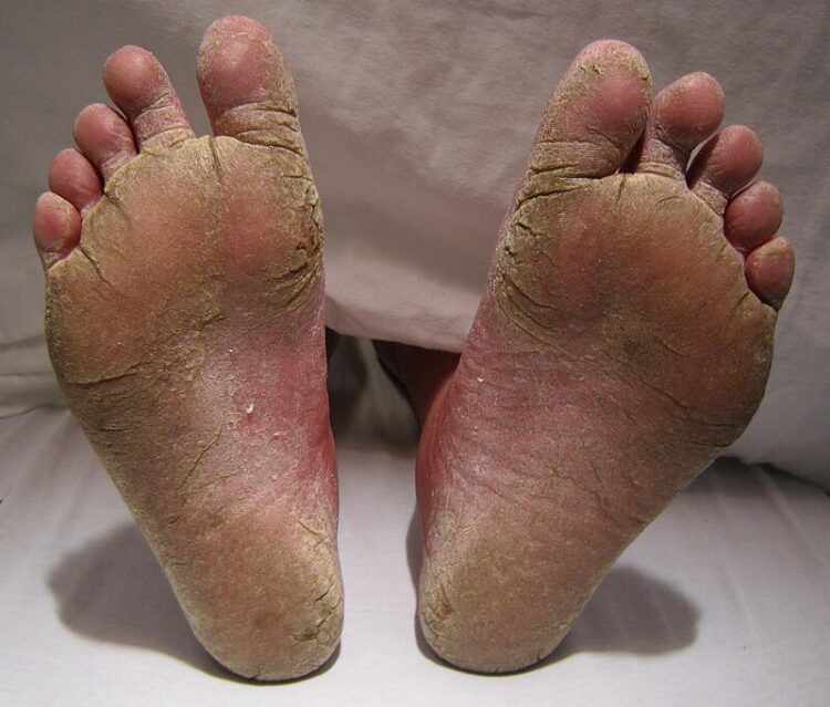 kaniya harden feet