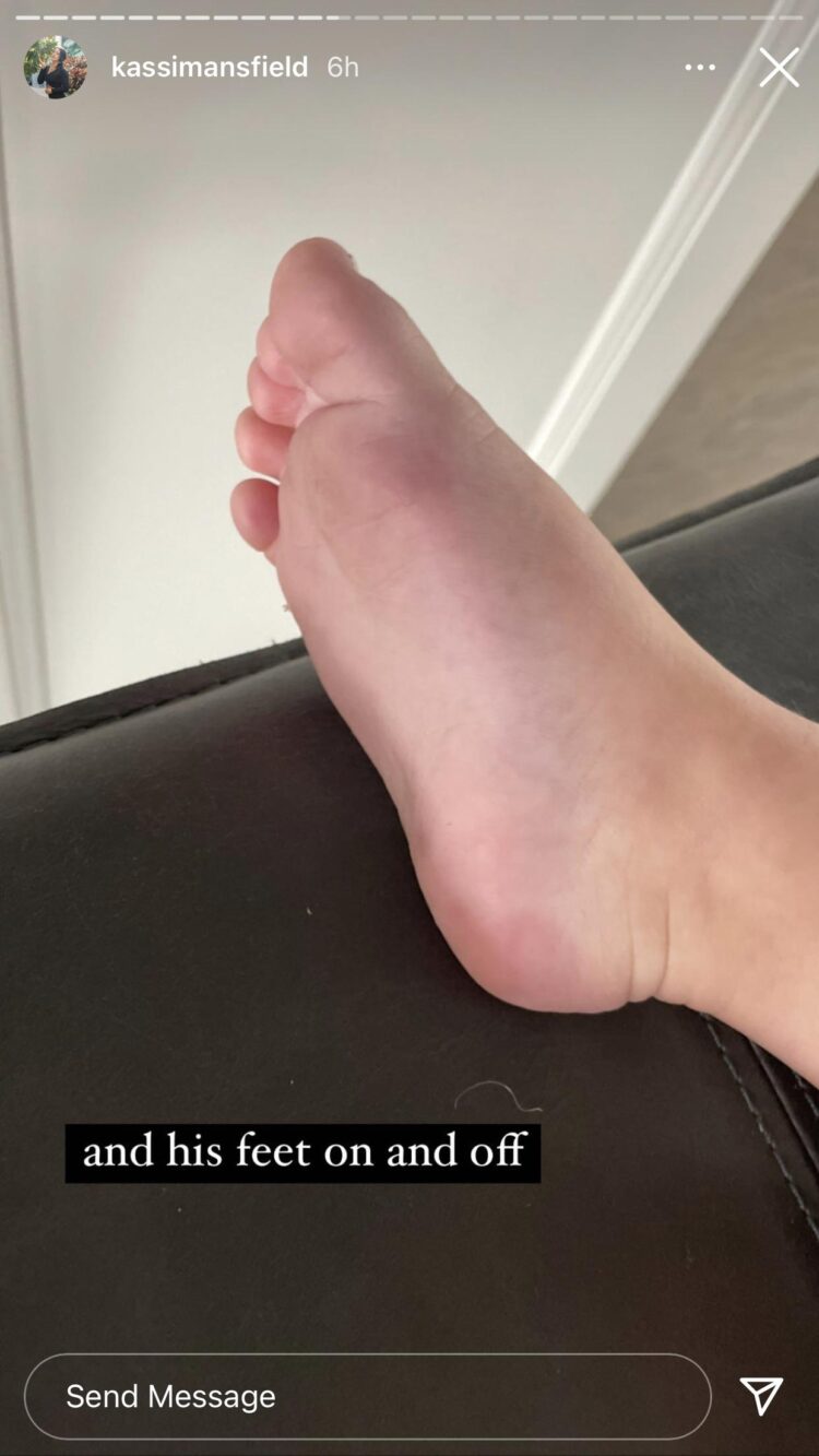 kassi mansfield feet
