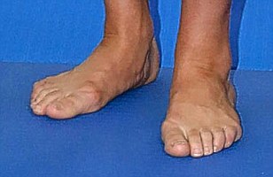 kate middleton feet 4