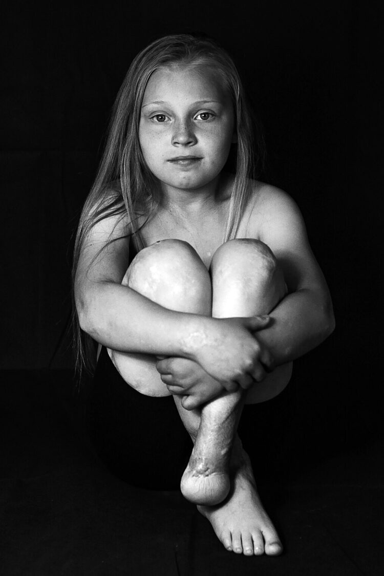 kate.brogan feet 1 scaled