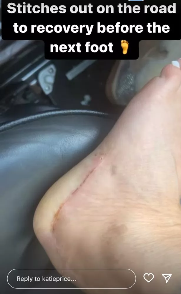 katie ann lewis feet 3