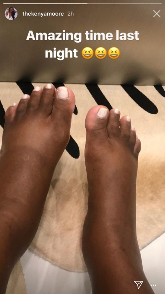 kennia feet