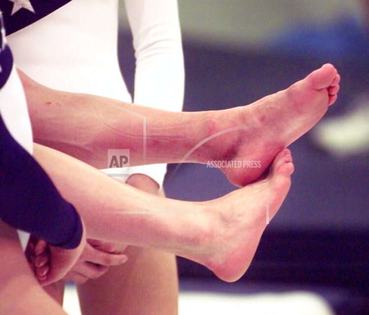 kerri strug feet 6