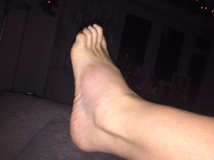 kerry katona feet 5