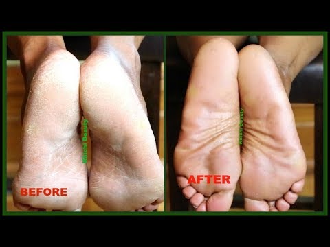 khichi beauty feet 2