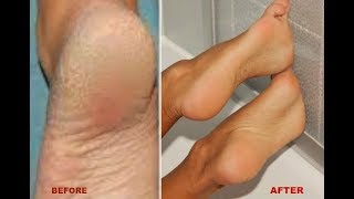 khichi beauty feet 3