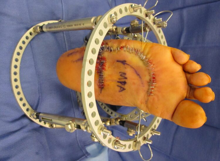 kimia d feet 2 scaled