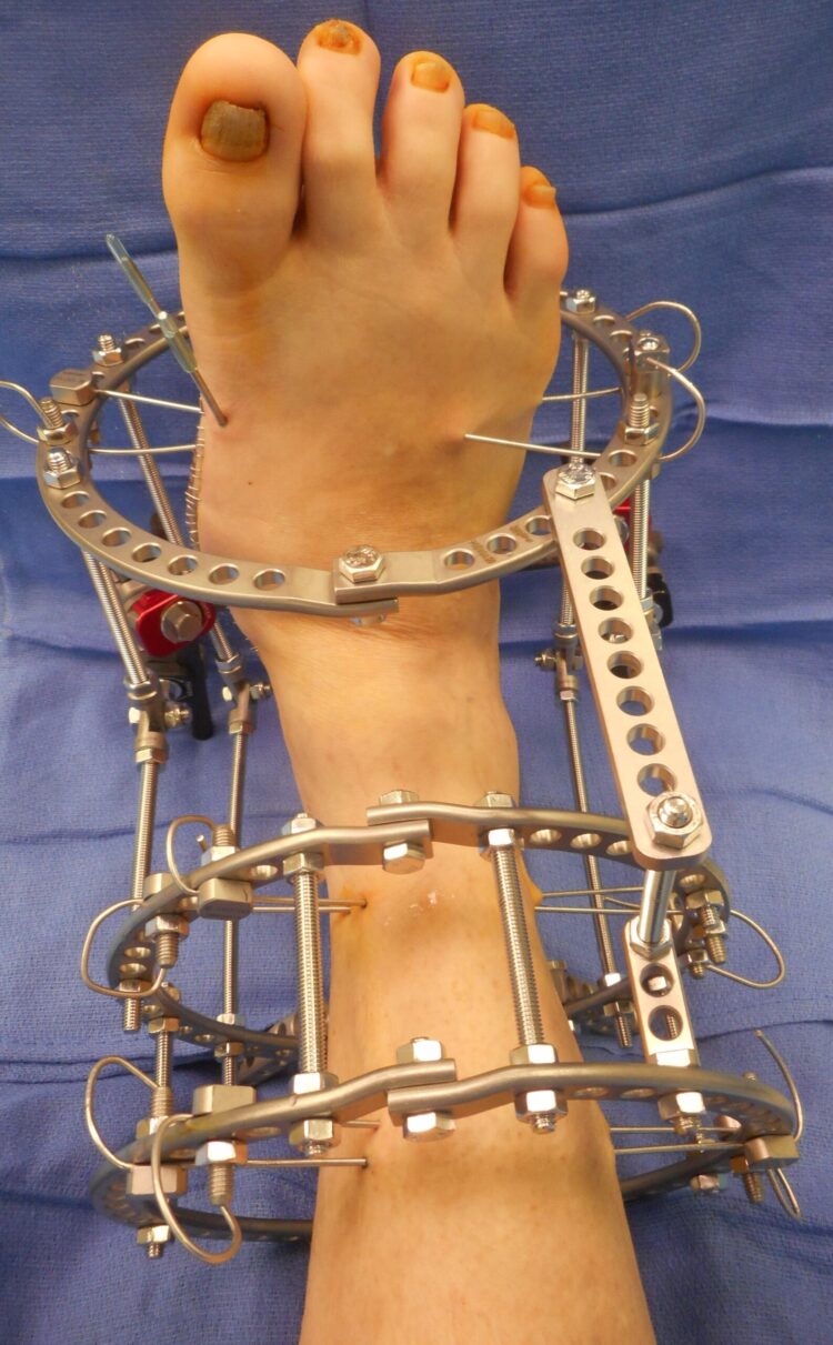 kimia d feet 4 scaled