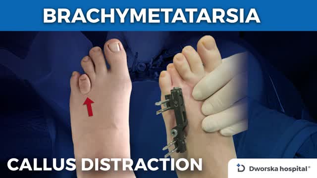 kisty rodriguez feet 3