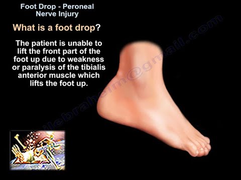 l4 raposa feet 1