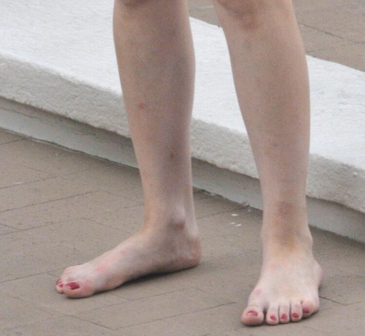 lady gaga feet 1
