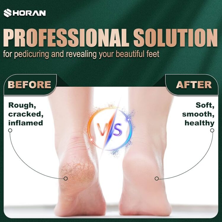 langolino di spina feet 5