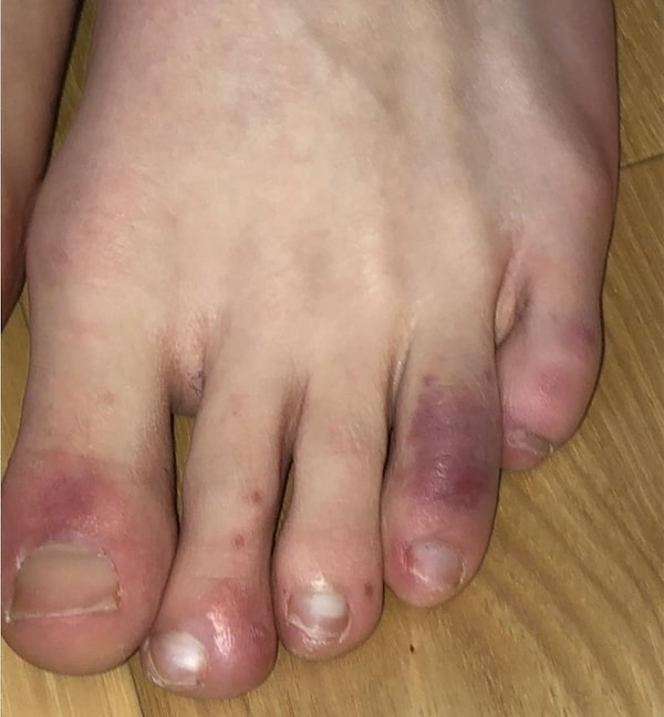 lara corrales feet 3