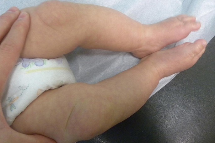 lara corrales feet 5