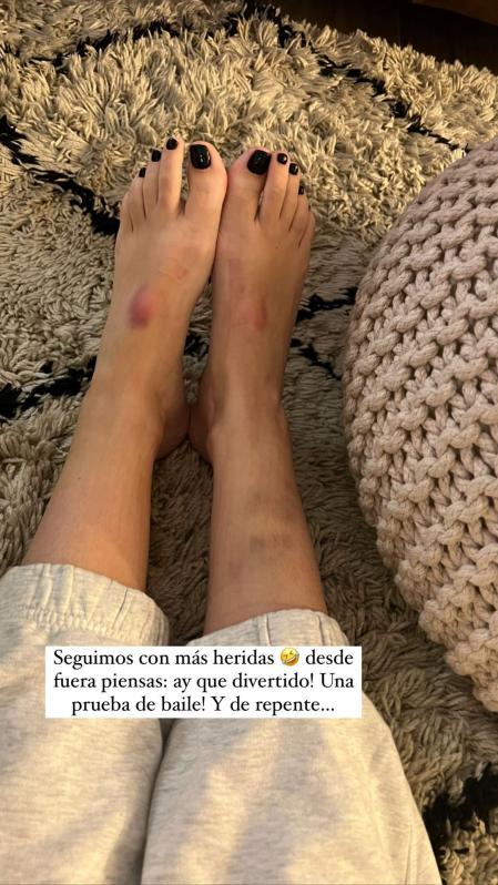 laura escanes feet