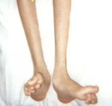 laura otoole feet 6