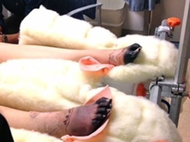 lauren wasser feet 3