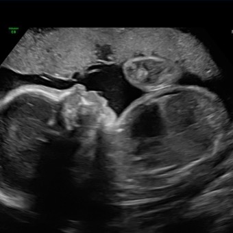 leah leahandkevin feet