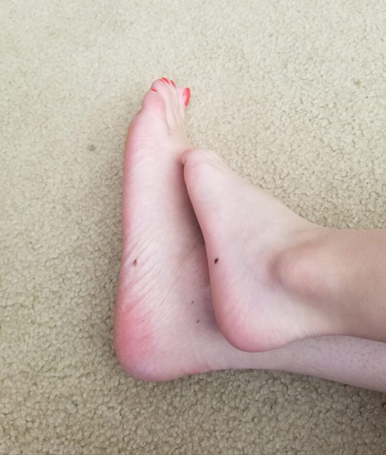 lil freckles feet 6 scaled