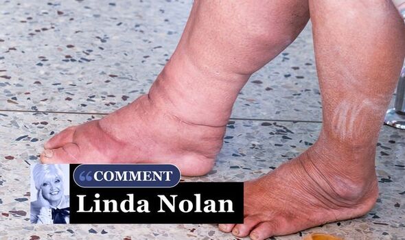 linda nolan feet 6