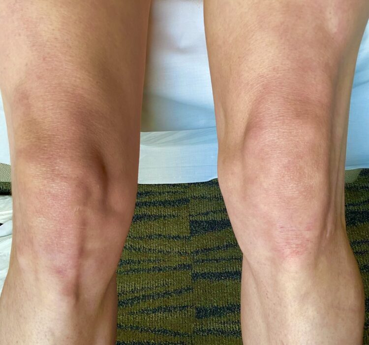 Lindsay Kay Hayward Feet