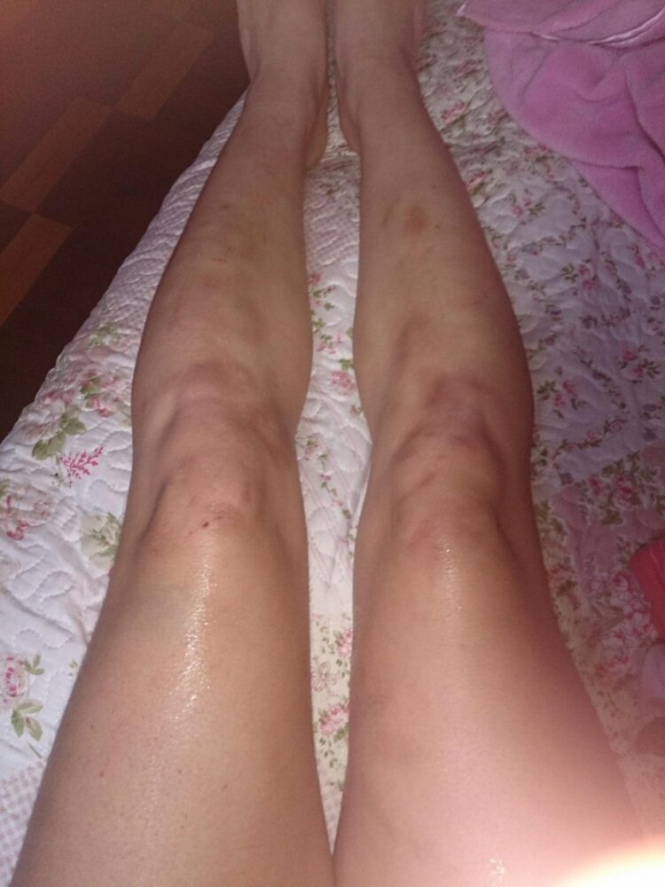 lisset lanao feet scaled