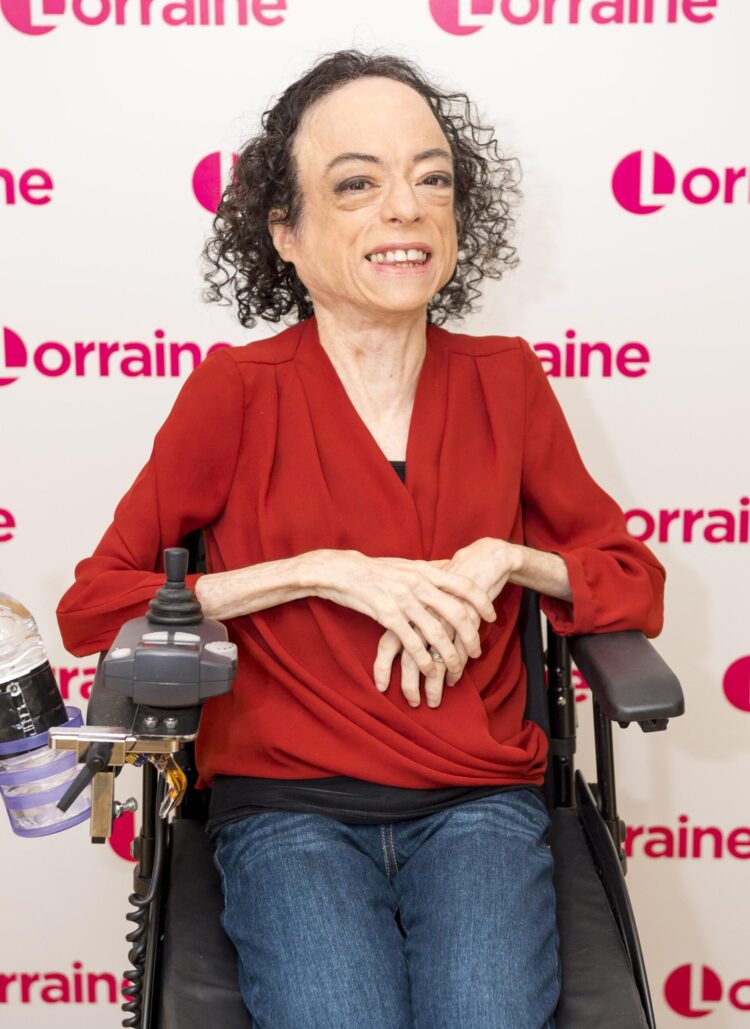 liz carr feet 1 scaled