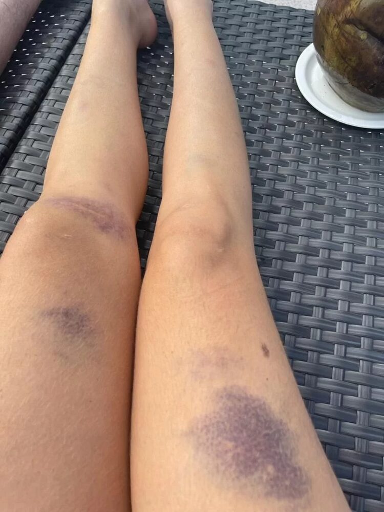 liziane gutierrez feet 6