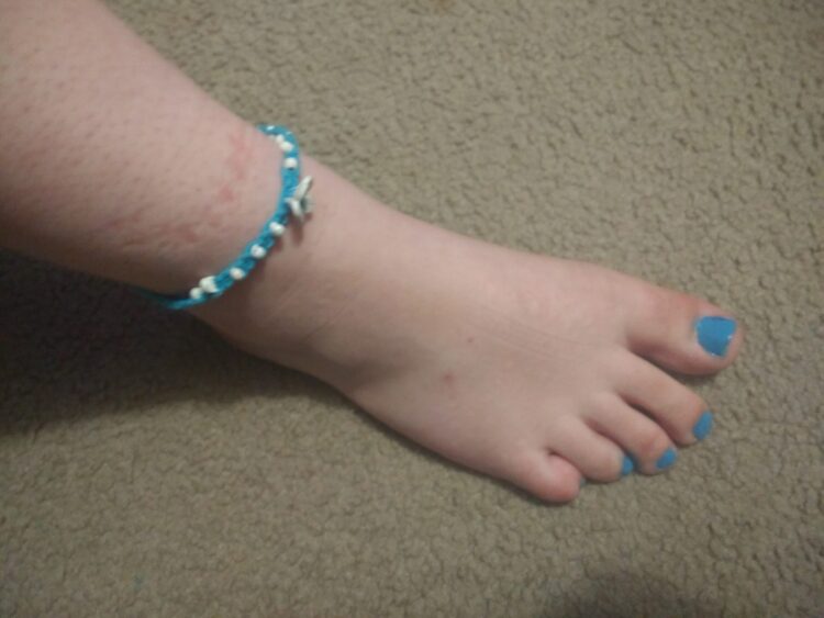 lizzie sider feet scaled