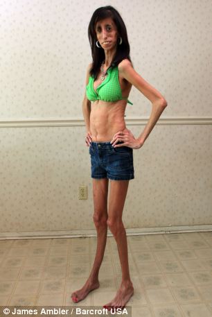 lizzie velasquez feet 2