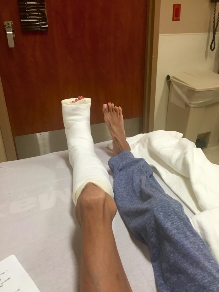 lizzie velasquez feet 3 scaled