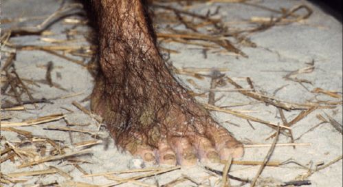 lucy st louis feet 1