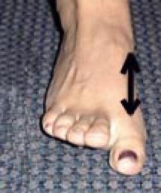 lynn crawford feet 4