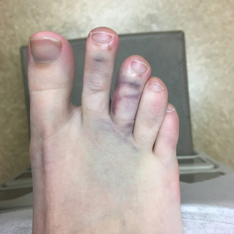 maddie morris feet 3