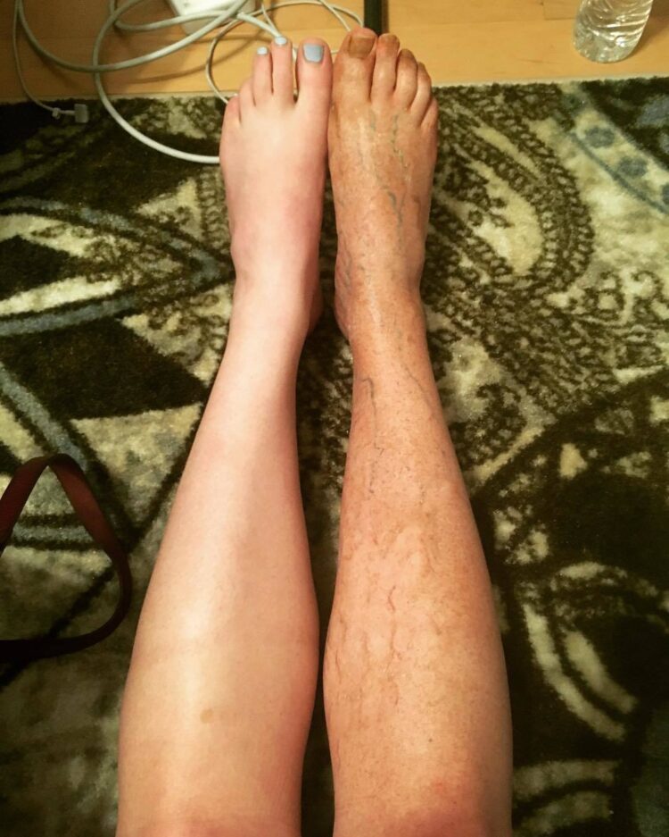 mallory everton feet 3