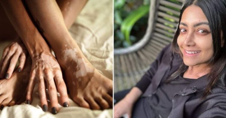 mamta mohandas feet 5