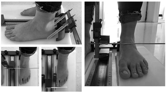 mar lucas vilar feet 4