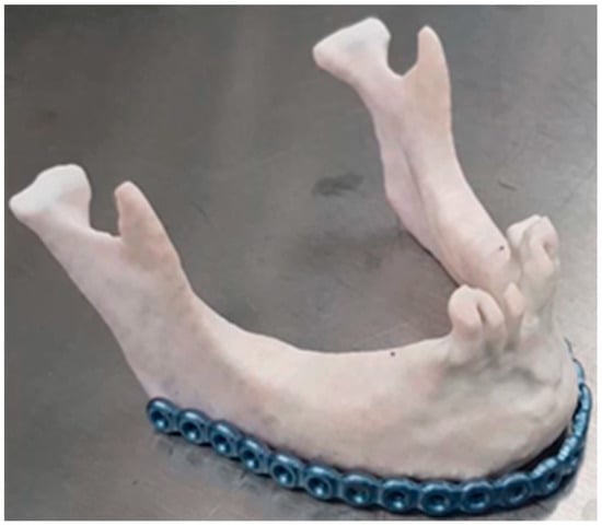 marcelli becker feet 5