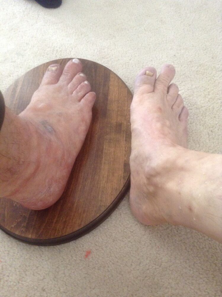 margaret atwood feet