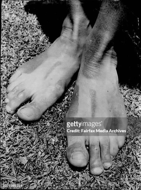 margaret court feet