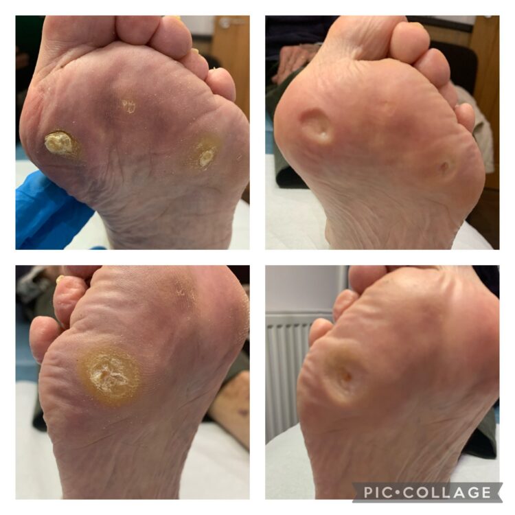 Margaret Whitton Feet