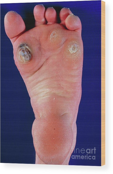 margaret wood feet 3