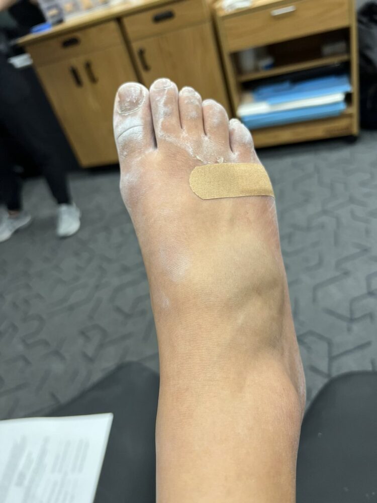 margzetta frazier feet 6