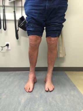 marie the g team feet 6